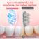 Bàn chải điện Unie UET518P đầu chải dao động, LED trắng răng - Ảnh 11